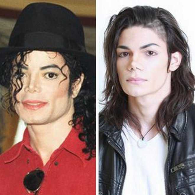 Двойника Майкла Джексона обвиняют в многочисленных пластических операциях