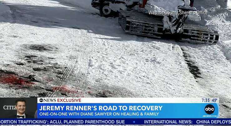 Актер «Мстителей» Джереми Реннер поделился фото с места аварии, при которой он сломал более 30 костей